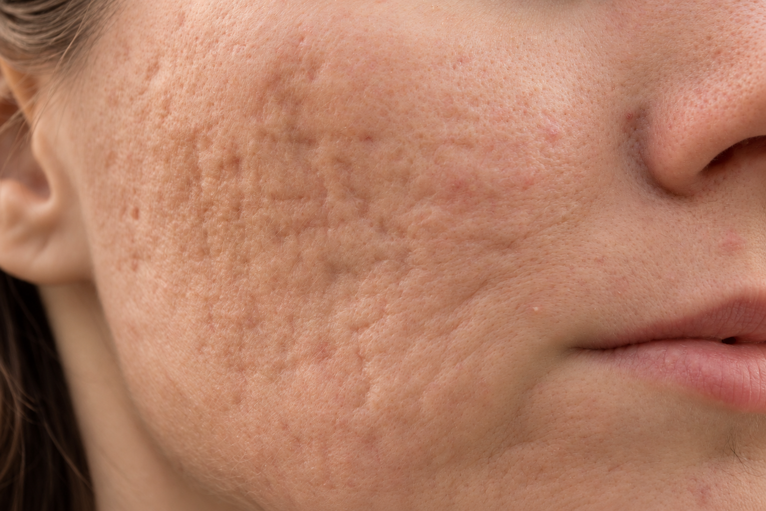 Skin Consultation in Calgary